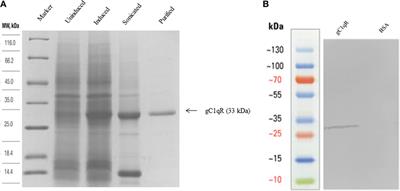 Analysis of the Interaction between Globular Head Modules of Human C1q and Its Candidate Receptor gC1qR